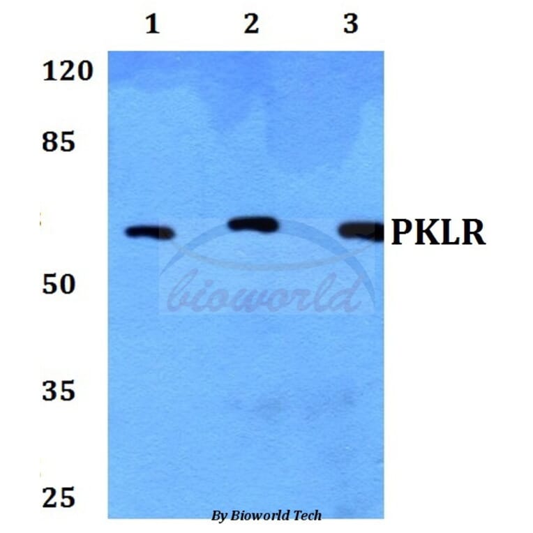 Anti-PKLR Antibody from Bioworld Technology (BS60443) - Antibodies.com