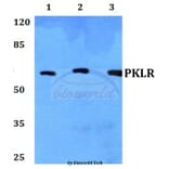 Anti-PKLR Antibody from Bioworld Technology (BS60443) - Antibodies.com