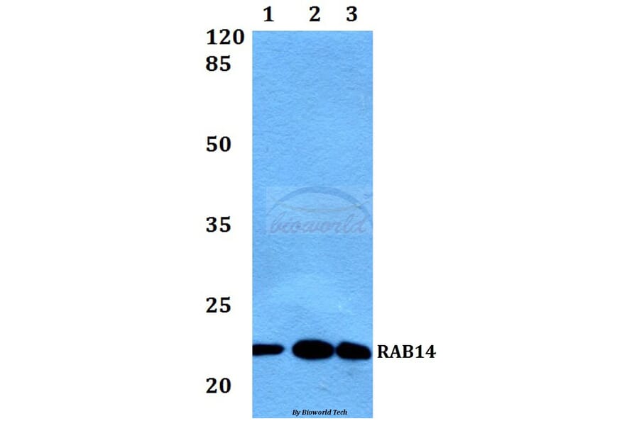 Anti-RAB14 Antibody from Bioworld Technology (BS60444) - Antibodies.com
