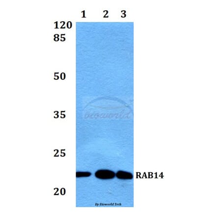 Anti-RAB14 Antibody from Bioworld Technology (BS60444) - Antibodies.com