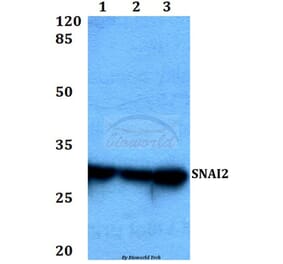 Anti-SNAI2 Antibody from Bioworld Technology (BS60447) - Antibodies.com