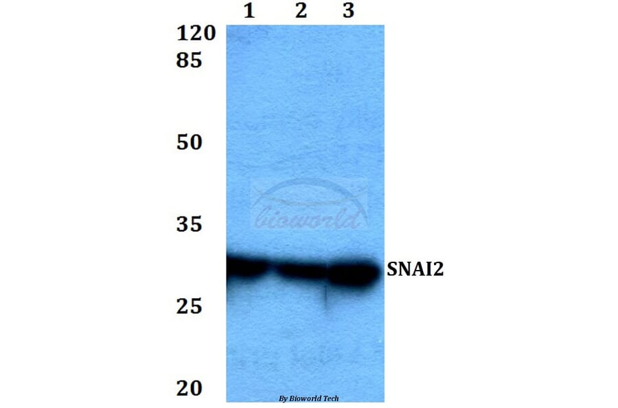 Anti-SNAI2 Antibody from Bioworld Technology (BS60447) - Antibodies.com