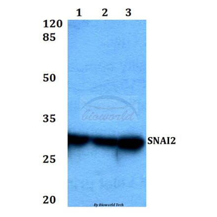 Anti-SNAI2 Antibody from Bioworld Technology (BS60447) - Antibodies.com