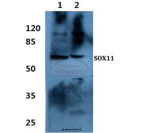 Anti-SOX11 Antibody from Bioworld Technology (BS60448) - Antibodies.com