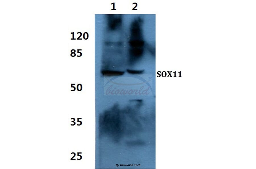 Anti-SOX11 Antibody from Bioworld Technology (BS60448) - Antibodies.com