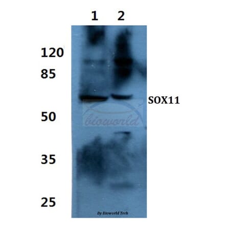 Anti-SOX11 Antibody from Bioworld Technology (BS60448) - Antibodies.com
