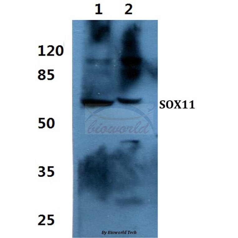 Anti-SOX11 Antibody from Bioworld Technology (BS60448) - Antibodies.com
