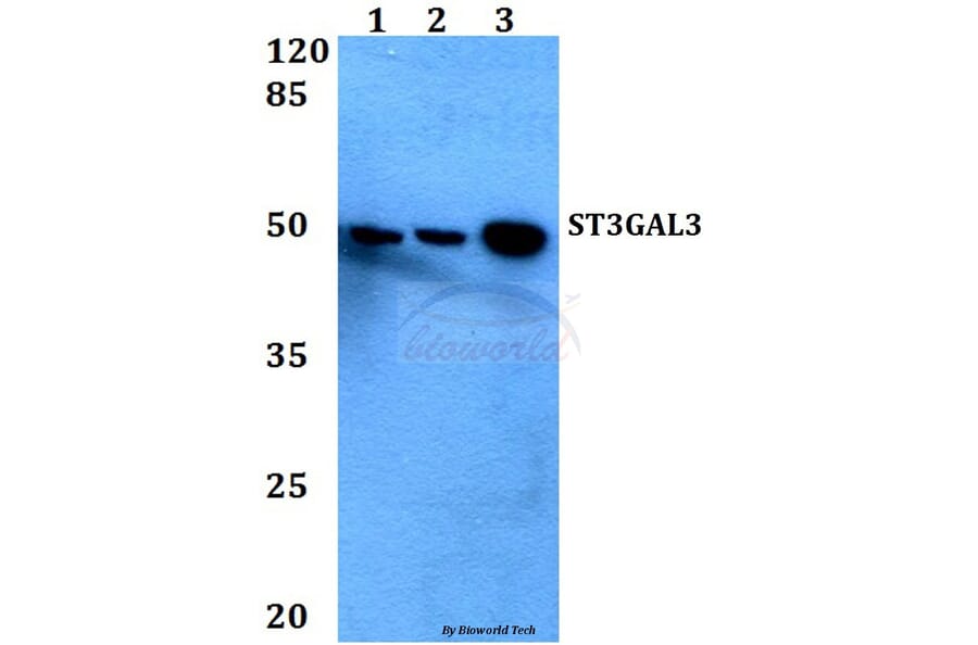 Anti-ST3GAL3 Antibody from Bioworld Technology (BS60449) - Antibodies.com
