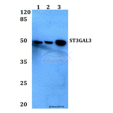 Anti-ST3GAL3 Antibody from Bioworld Technology (BS60449) - Antibodies.com