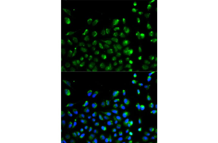 Anti-ATG13 Antibody from Bioworld Technology (BS6045) - Antibodies.com