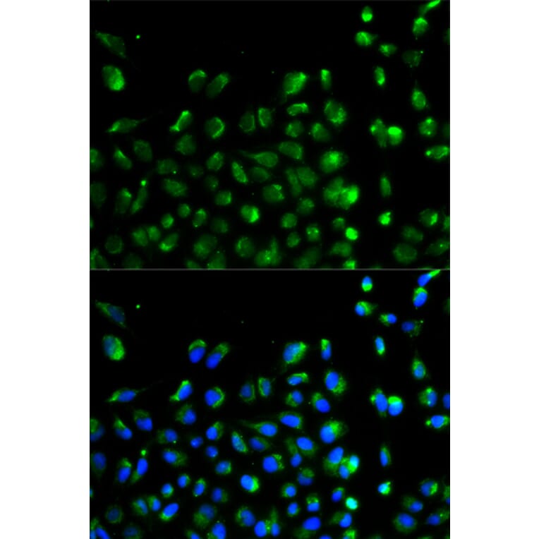 Anti-ATG13 Antibody from Bioworld Technology (BS6045) - Antibodies.com