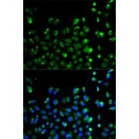 Anti-ATG13 Antibody from Bioworld Technology (BS6045) - Antibodies.com