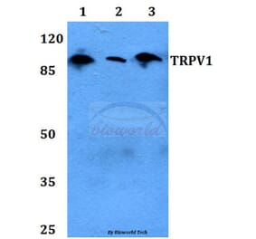 Anti-TRPV1 Antibody from Bioworld Technology (BS60454) - Antibodies.com