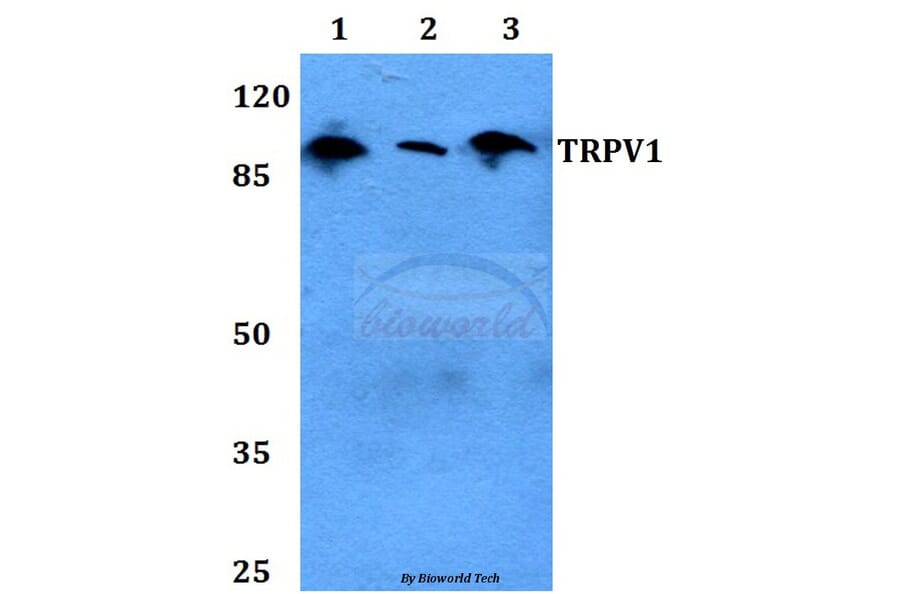 Anti-TRPV1 Antibody from Bioworld Technology (BS60454) - Antibodies.com