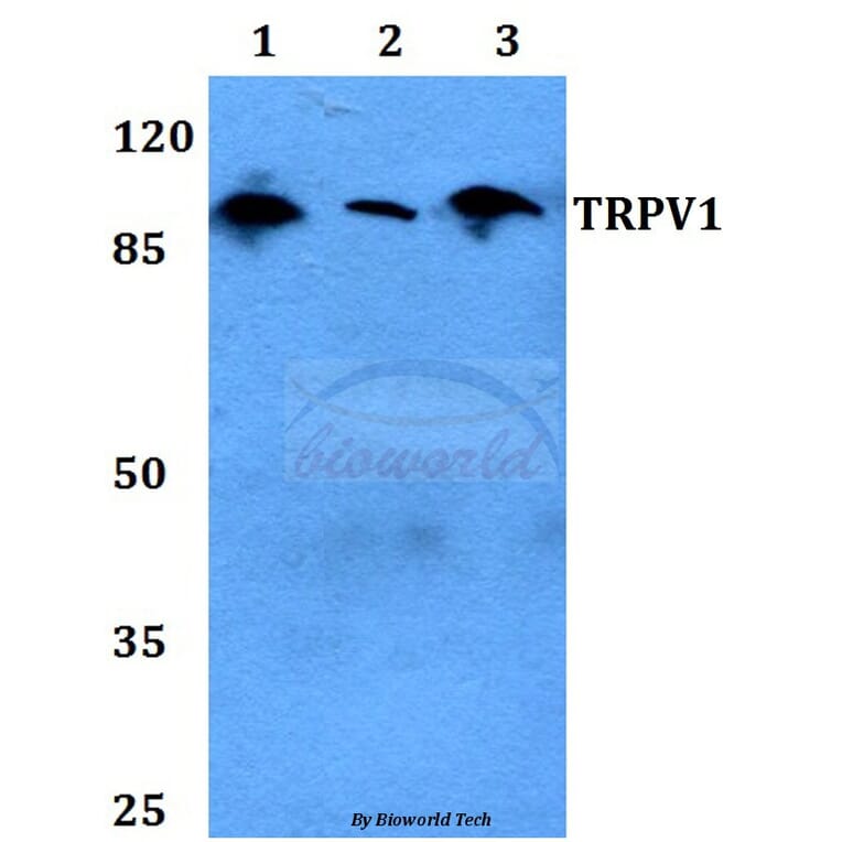 Anti-TRPV1 Antibody from Bioworld Technology (BS60454) - Antibodies.com