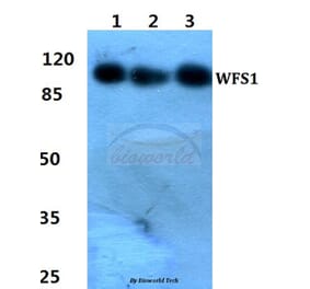 Anti-WFS1 Antibody from Bioworld Technology (BS60455) - Antibodies.com