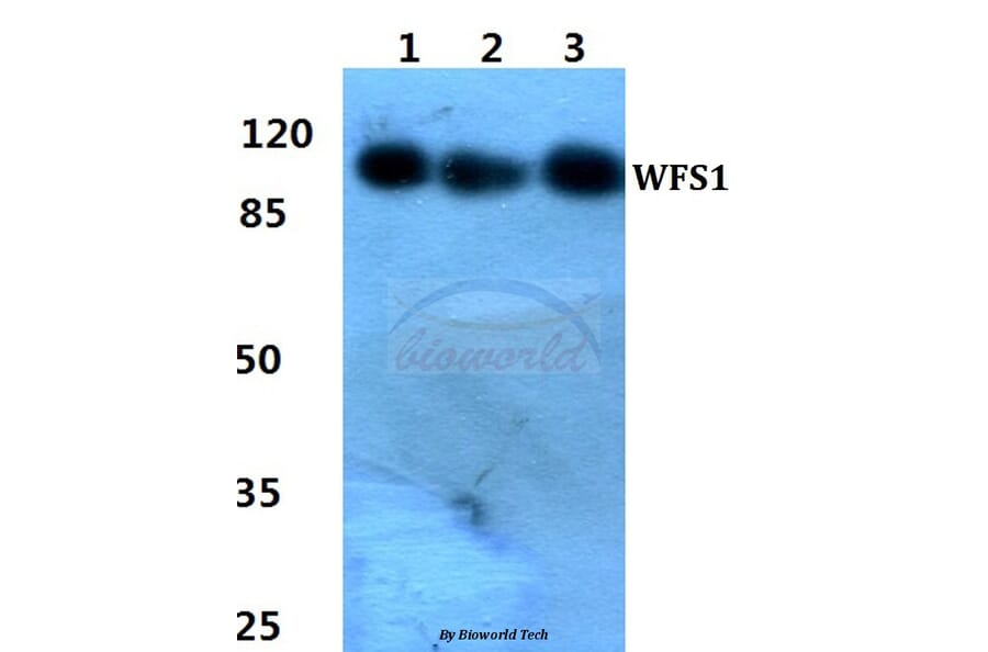 Anti-WFS1 Antibody from Bioworld Technology (BS60455) - Antibodies.com