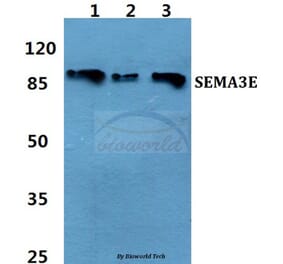 Anti-SEMA3E Antibody from Bioworld Technology (BS60460) - Antibodies.com