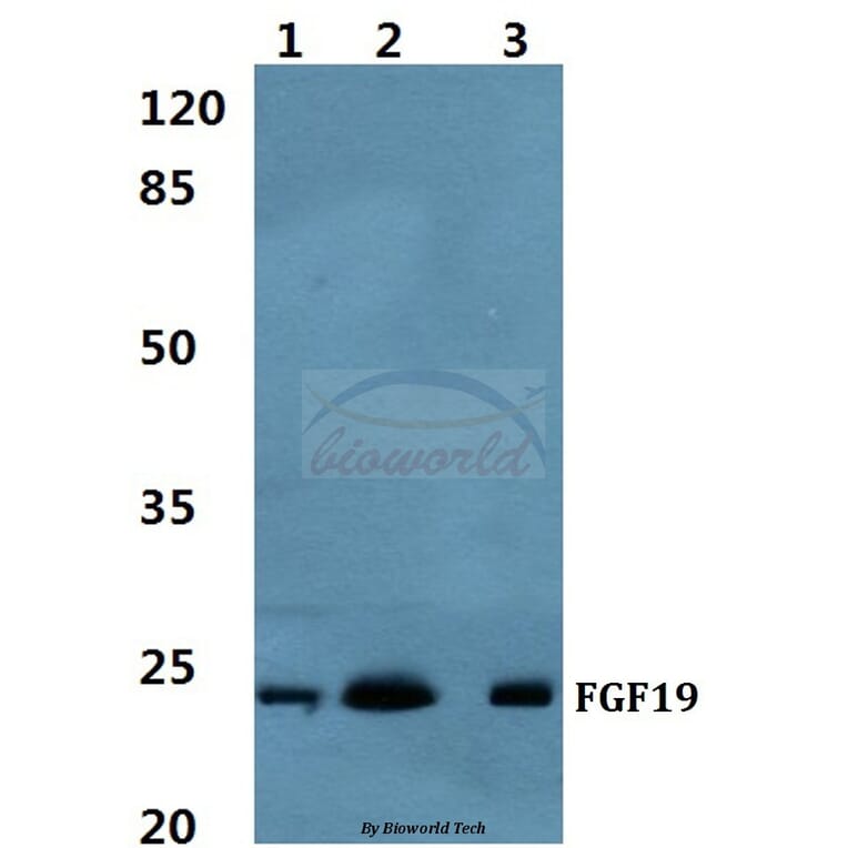 Anti-FGF19 Antibody from Bioworld Technology (BS60461) - Antibodies.com