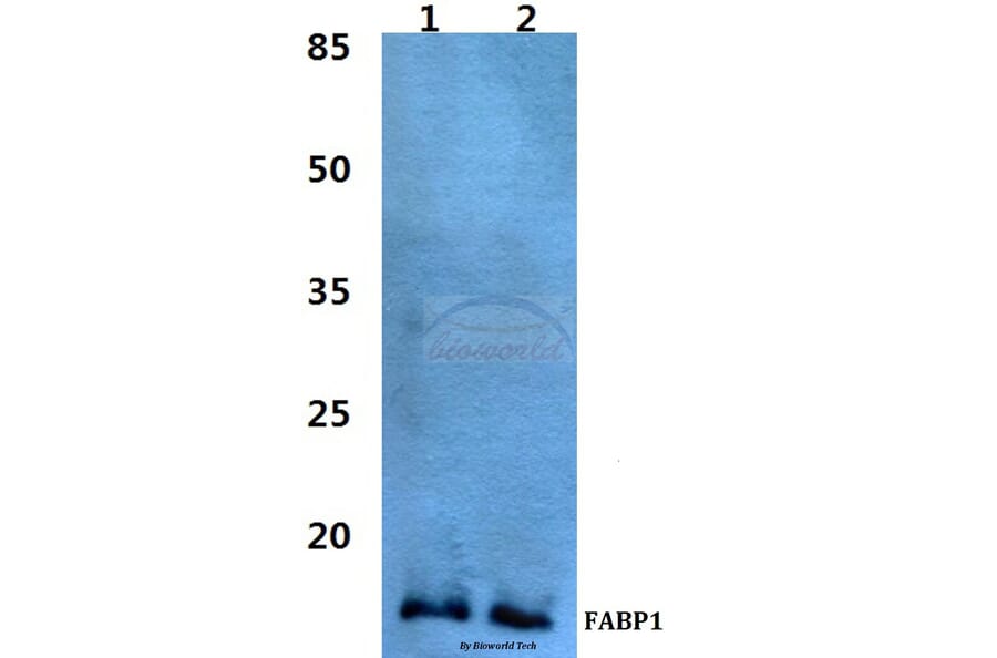 Anti-FABP1 Antibody from Bioworld Technology (BS60462) - Antibodies.com