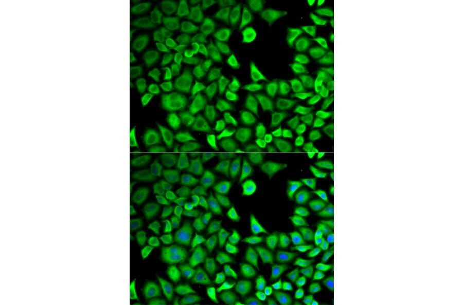 Anti-LTA4H Antibody from Bioworld Technology (BS6047) - Antibodies.com