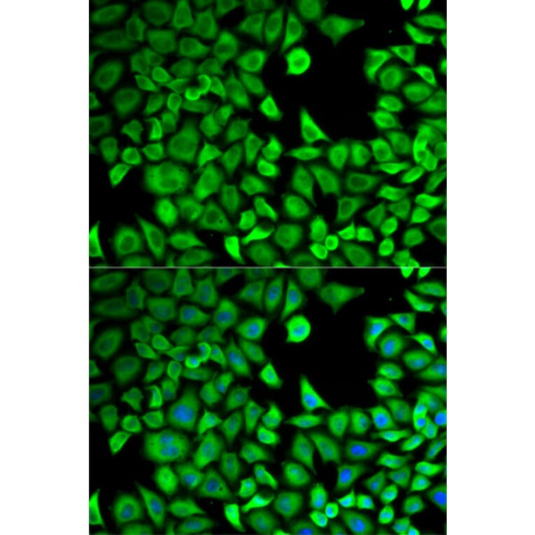Anti-LTA4H Antibody from Bioworld Technology (BS6047) - Antibodies.com