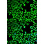 Anti-LTA4H Antibody from Bioworld Technology (BS6047) - Antibodies.com