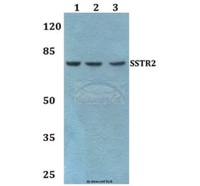 Anti-SSTR2 Antibody from Bioworld Technology (BS60470) - Antibodies.com