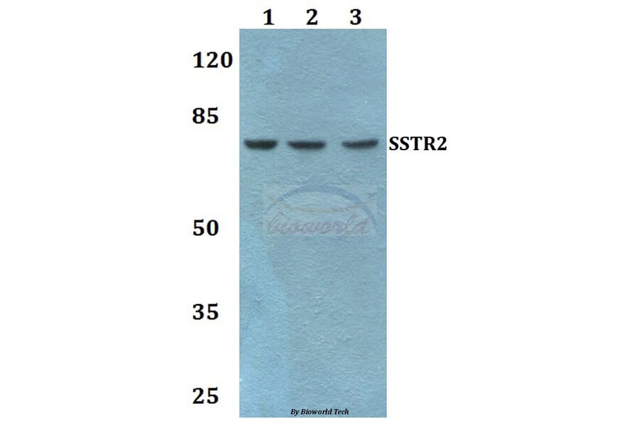 Anti-SSTR2 Antibody from Bioworld Technology (BS60470) - Antibodies.com