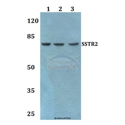 Anti-SSTR2 Antibody from Bioworld Technology (BS60470) - Antibodies.com