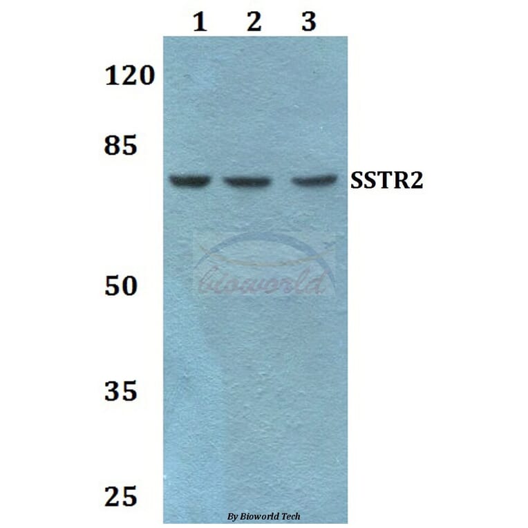 Anti-SSTR2 Antibody from Bioworld Technology (BS60470) - Antibodies.com