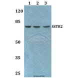 Anti-SSTR2 Antibody from Bioworld Technology (BS60470) - Antibodies.com