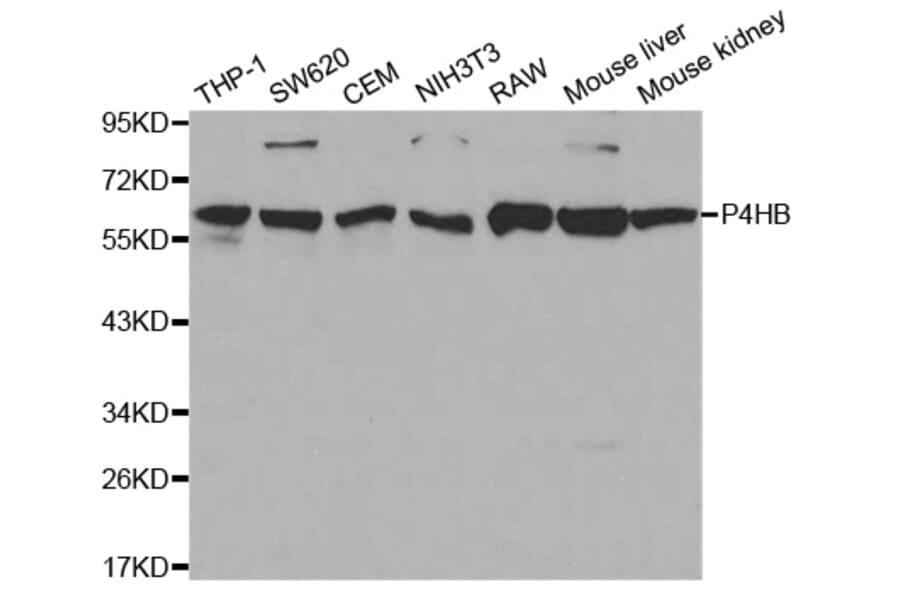 Anti-P4HB Antibody from Bioworld Technology (BS6048) - Antibodies.com