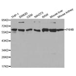 Anti-P4HB Antibody from Bioworld Technology (BS6048) - Antibodies.com