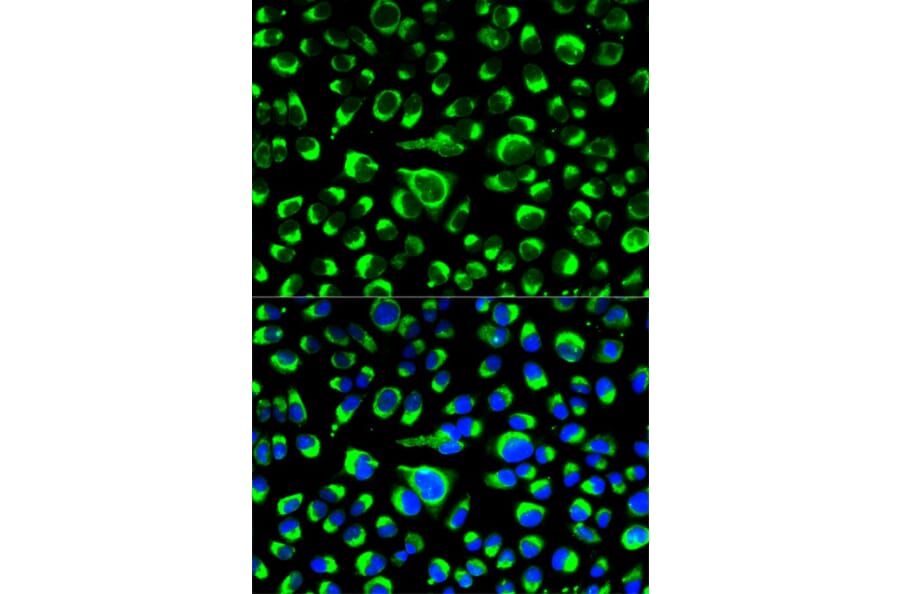 Anti-P4HB Antibody from Bioworld Technology (BS6048) - Antibodies.com