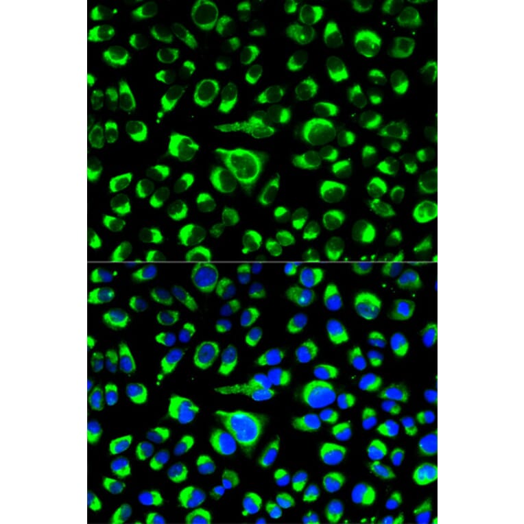 Anti-P4HB Antibody from Bioworld Technology (BS6048) - Antibodies.com