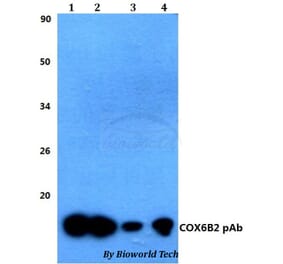 Anti-COX6B2 Antibody from Bioworld Technology (BS60483) - Antibodies.com