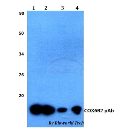 Anti-COX6B2 Antibody from Bioworld Technology (BS60483) - Antibodies.com