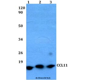 Anti-CCL11 Antibody from Bioworld Technology (BS60485) - Antibodies.com