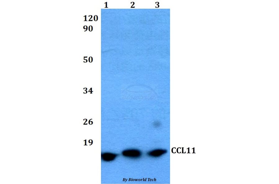 Anti-CCL11 Antibody from Bioworld Technology (BS60485) - Antibodies.com