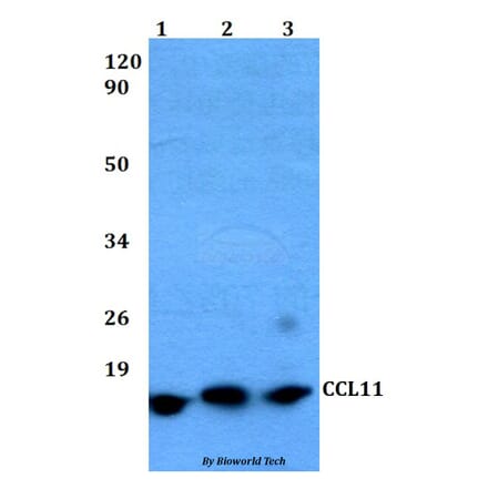 Anti-CCL11 Antibody from Bioworld Technology (BS60485) - Antibodies.com