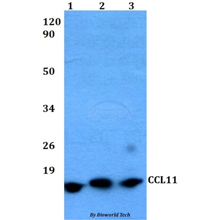 Anti-CCL11 Antibody from Bioworld Technology (BS60485) - Antibodies.com