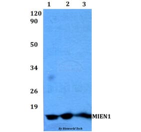 Anti-MIEN1 Antibody from Bioworld Technology (BS60489) - Antibodies.com