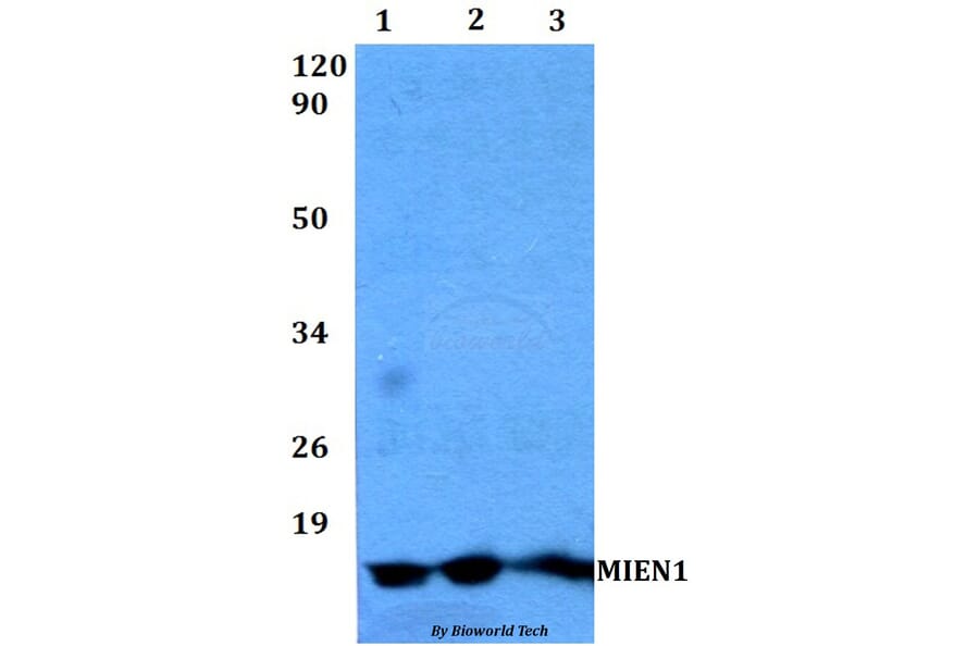 Anti-MIEN1 Antibody from Bioworld Technology (BS60489) - Antibodies.com