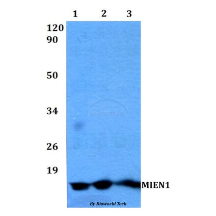Anti-MIEN1 Antibody from Bioworld Technology (BS60489) - Antibodies.com