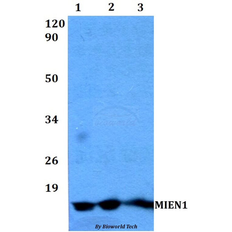 Anti-MIEN1 Antibody from Bioworld Technology (BS60489) - Antibodies.com