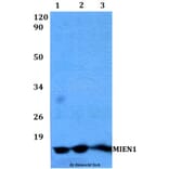 Anti-MIEN1 Antibody from Bioworld Technology (BS60489) - Antibodies.com
