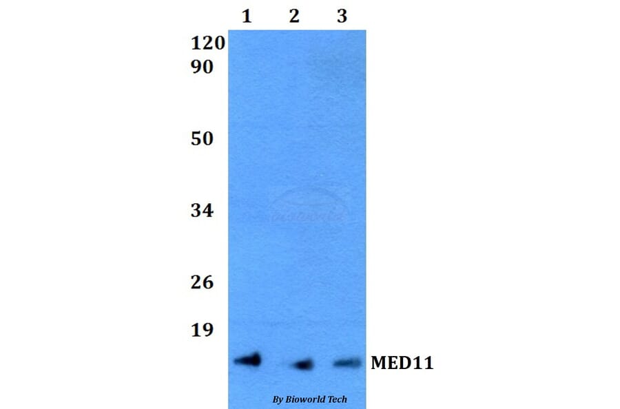 Anti-MED11 Antibody from Bioworld Technology (BS60491) - Antibodies.com