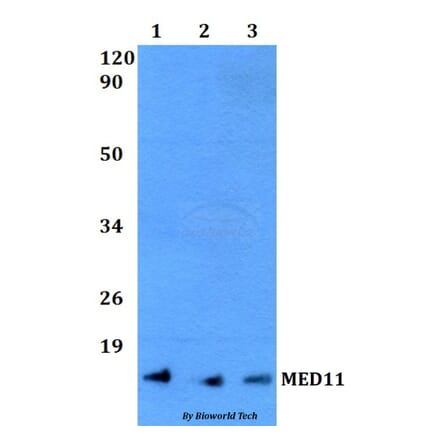 Anti-MED11 Antibody from Bioworld Technology (BS60491) - Antibodies.com