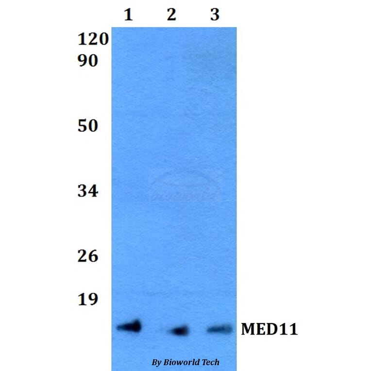 Anti-MED11 Antibody from Bioworld Technology (BS60491) - Antibodies.com